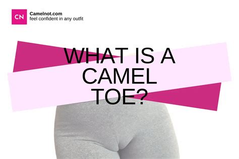 causes of camel toe|Camel Toes: Common Causes and 14 .